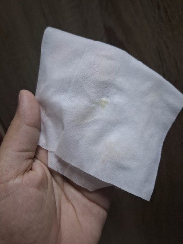 สอบถามสีตกขาว