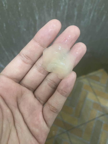มูกออกจากช่องคลอด