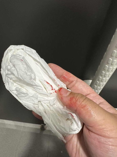 Bleeding @ 34 weeks