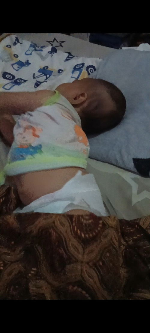 Bayi miring" umur 2 bulan