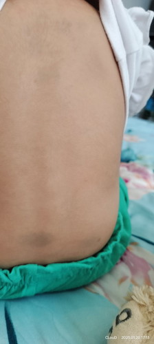Umur 1 tahun 4 bulan