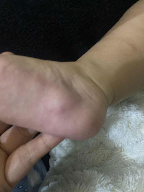 Kaki Bayi Kaya Memar