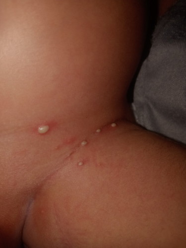 Mau nanya bunda2 ada yg pernah bayix bgni kah di selangkanganx sama ada juga 1 di belakang telingax