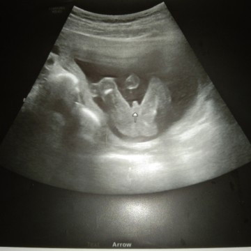 17+5 มีแต่คนทักจะได้ลูกสาว