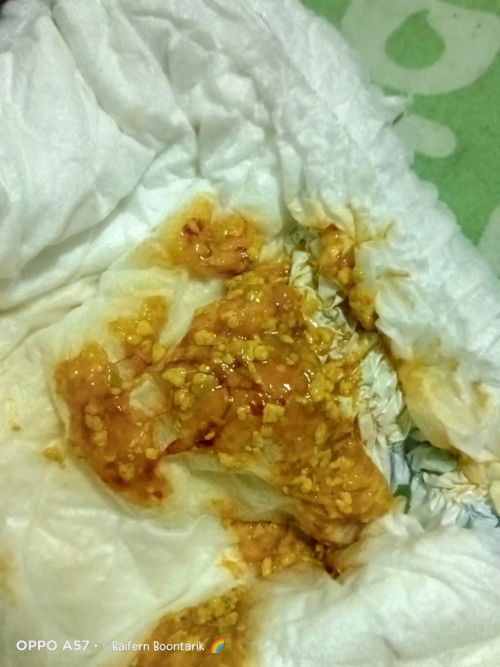 ลูกถ่ายมีมูกเลือดปน