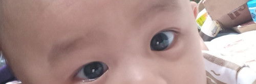 Mata bayi normal ga ya
