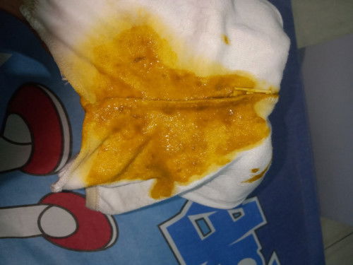 Sudah mau sebulan tekstur bab nya gak berubah