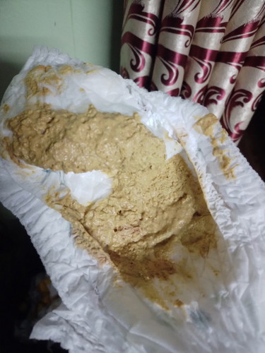 ลูกน้อยถ่ายแบบนี้ปกติไหมคะ