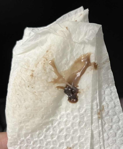 Mucus plug?