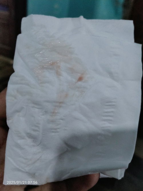 Ada yg sama di TM 1??