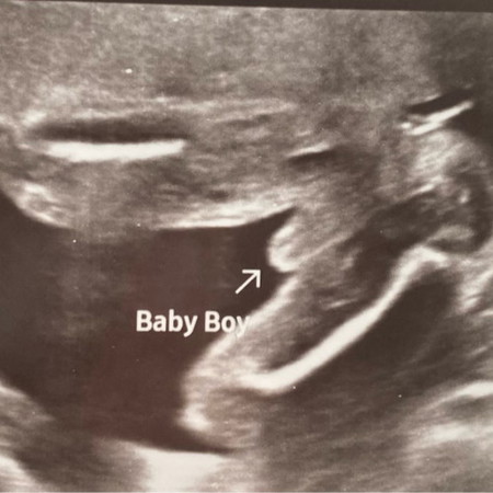 gender baby