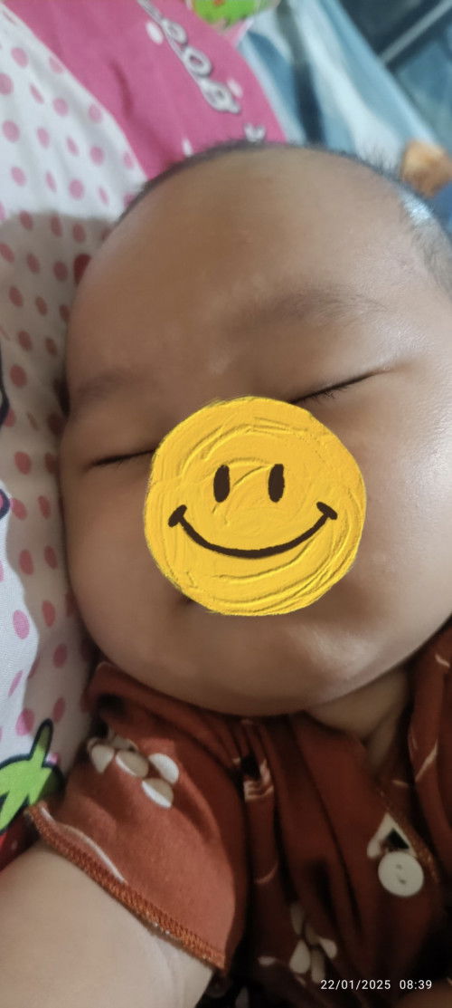 Bun, salep atau cream yang bisa ngilangin putih seperti panu di wajah?