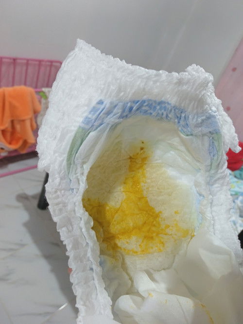 น้อง2เดือน อึแบบนี้ผิดปกติไหมค่ะ