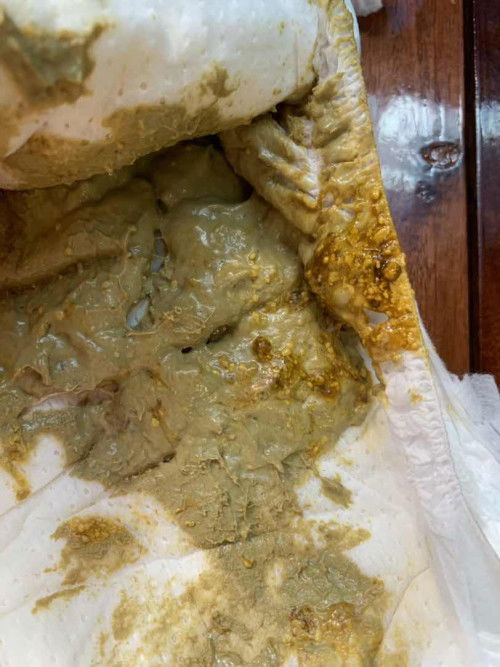 สอบถามค่ะแม่ๆหน่อยค่ะมีใครเคยเป็นไหม