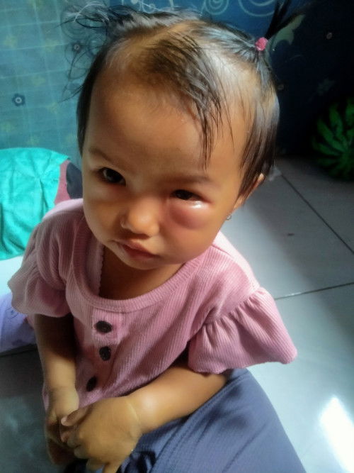 Bun ini knpa ya solusinya dong bngun tdr tau" bgini apa d gigit smut