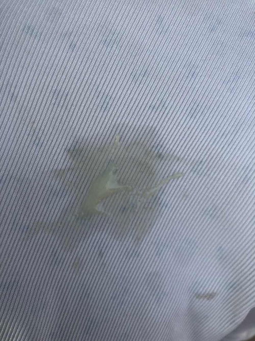 ตอนนี้37วีค มีอาการปวดท้องเหมือนประจำเดือนมาๆหายๆ อันนี้ส่งสัญญาณบอกอะไรไหมค่ะ