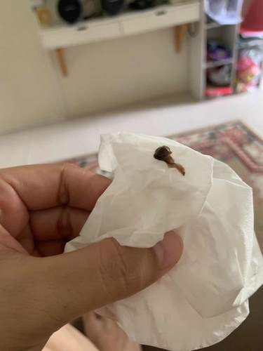 Lendir coklat di kehamilan 11 minggu