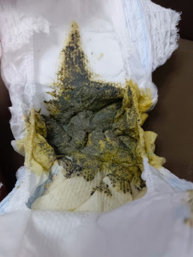 Hi mga mommies tanong ko lang kung normal ba yung poop ni LO ko! 7 months po sya ngayon