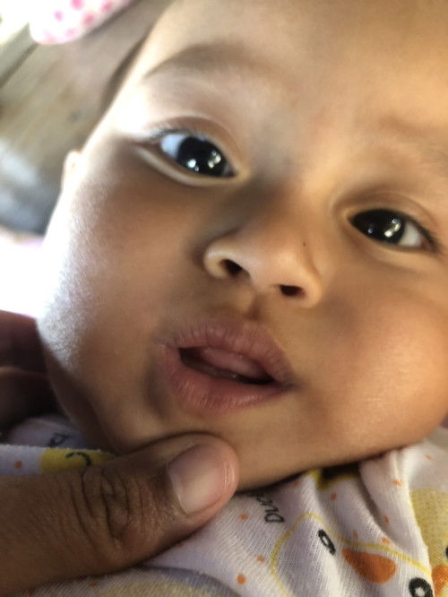 แบบนี้ฟันน้องจะขึ้นไหมค่ะแม่ๆ