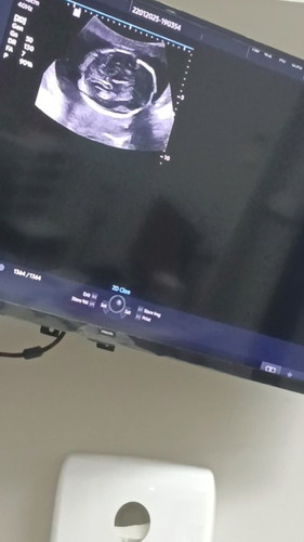 เพศของทารก