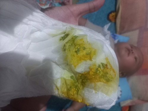 pup bayi 2 bulan ada lendir darah