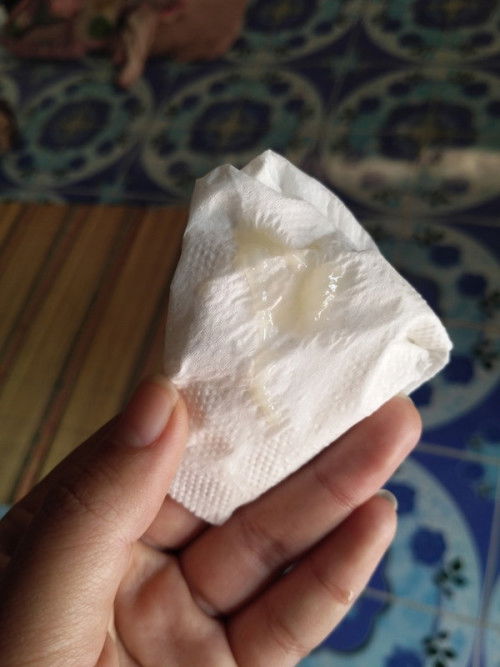 มูกใส คือสัญญาณใกล้คลอดใช่ไหม?