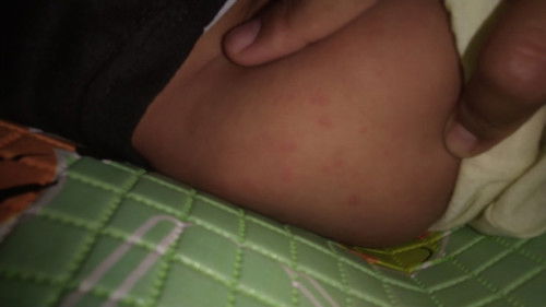 Maaf mommy saya new momm ingin bertanya kalau kayak gini kenapa yah?cara mengatasinya gimana?