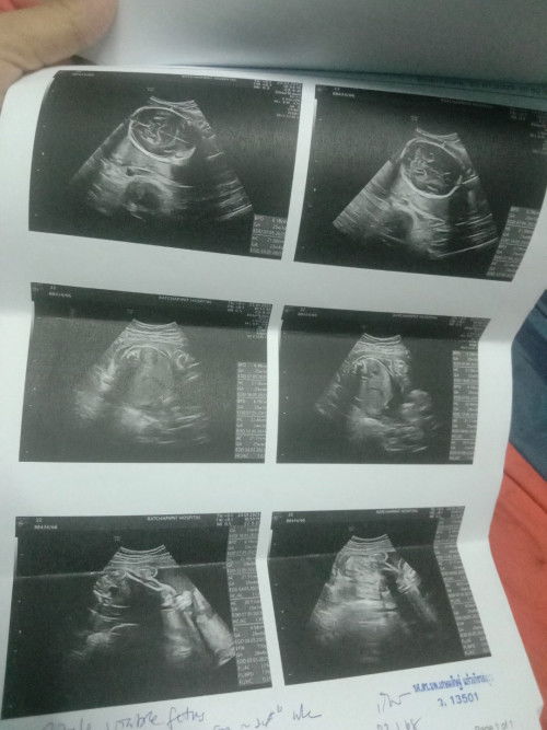 ดูเพศอยุ่ภาพไหนคะดูใม่ออกเลย