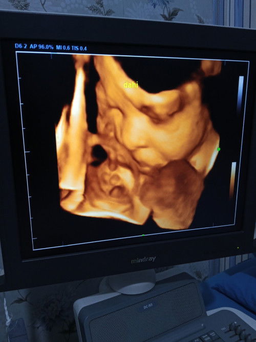 4D anak ketiga 32weeks