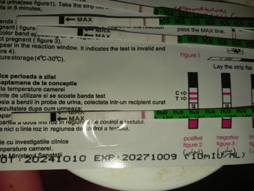 อาการแพ้ท้อง