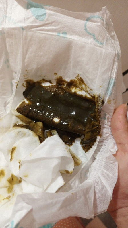 Fases bayi baru lahir