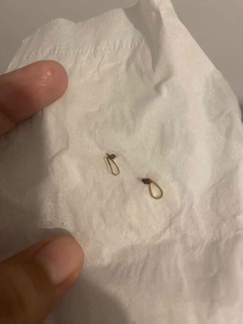 Benang jahitan lepas