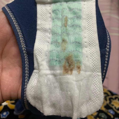 Keputihan berubah warna