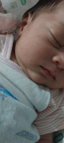 ผื่นแบบนี้ทำยังไงคะ