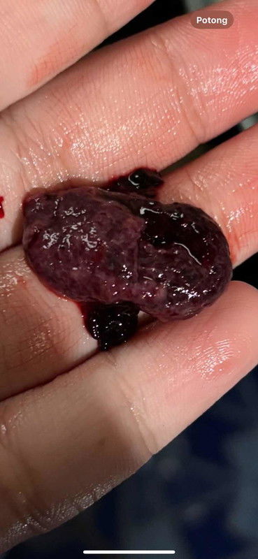 Apakah ini keguguran?