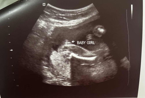 Boy or girl?