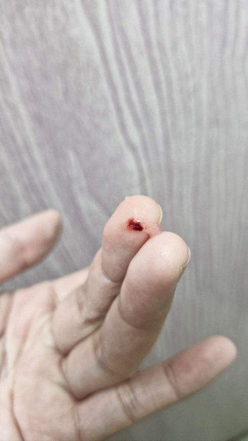 Darah spotting atau apa