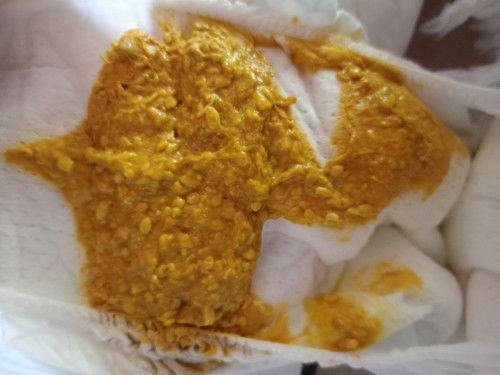 น้องอึปกติมั้ยคะแบบนี้ น้องได้ 3เดือน 3 วันคะ  ลูกคนเเรกคะ