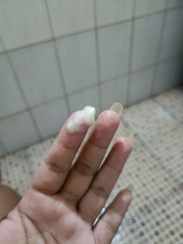 อาการปวดท้อง