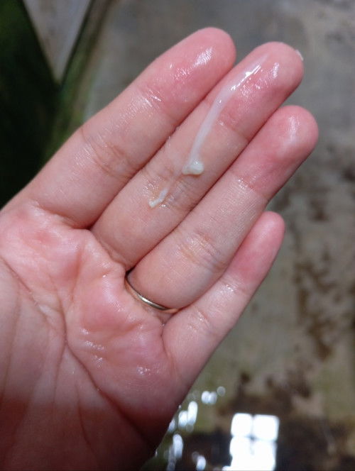 Cek lab keputihan.. Yang jijian jangan buka fotonya ya bunda"