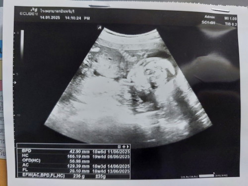 อยากรู้เพศลูก