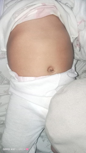 hello po ask kolang po normal lang poba lako ng chan ng baby ko formula milk posya salamat po