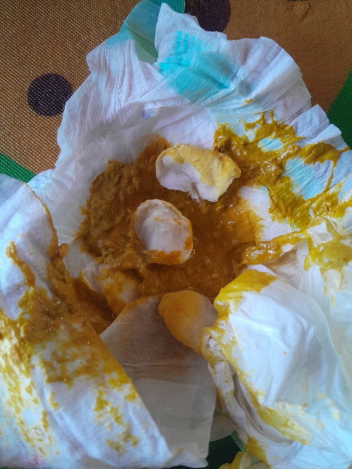 สอบถามแม่ๆหน่อยค่ะ