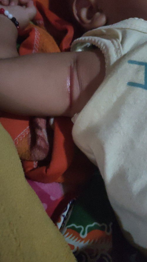 Bun kira kira kenapa ya ini apa biang keringat apa"iy solusi nya dong Bun obat nya apa