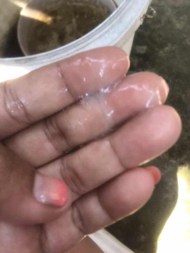 แม่ๆคะ 38+2 มีมูกแบบนี้ปกติไหมคะ ไม่มีอาการอะไรเลย ไม่มีกลิ่น ไม่แสบคัน ออกมาเยอะพอสมควรคะ