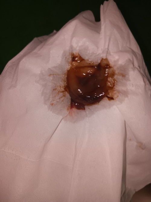 Usia kandungan 38 weeks