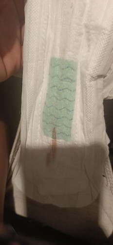 Ask kolang may possible ba na preggy ako? Till now. Wala pako mens
