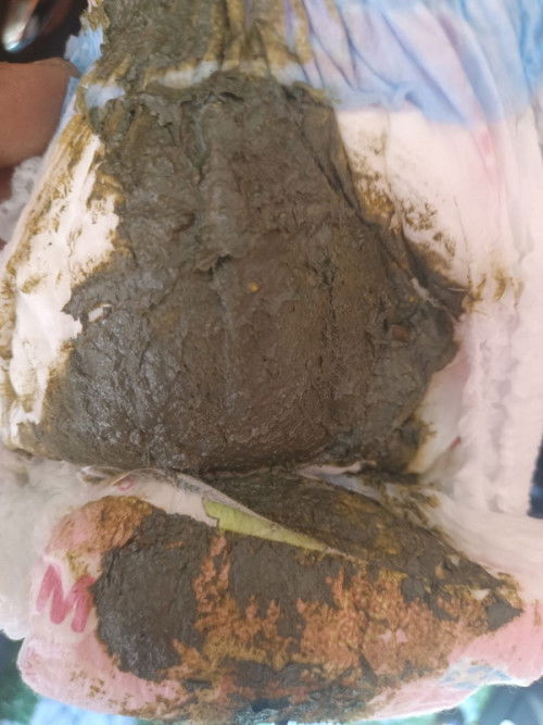 สีนี้ปกติไหมค่ะแม่ๆ