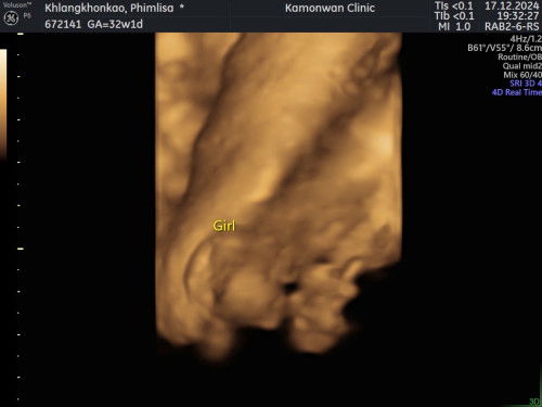 เเม่ๆช่วยดูหน่อยค่ะ