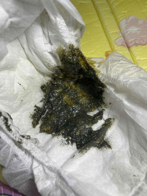 1เดือน10วัน กินผงล้วน นมตราหมีแบบนี้ปกติมั้ยคะ